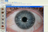 Image of iriscope iris analyzer