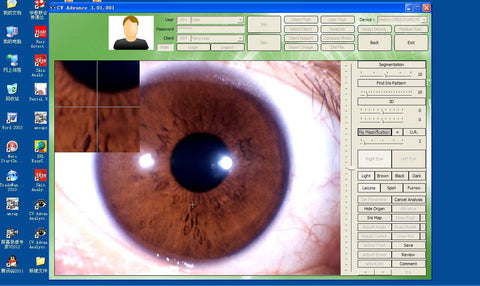 12mp iriscope support All of Windows system software with FEDEX Shipping charge to Bulgaria