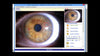Image of iriscope iris analyzer