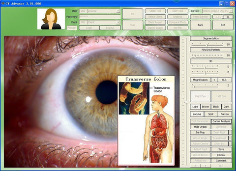 iridologycamera with english and spanish iridology software