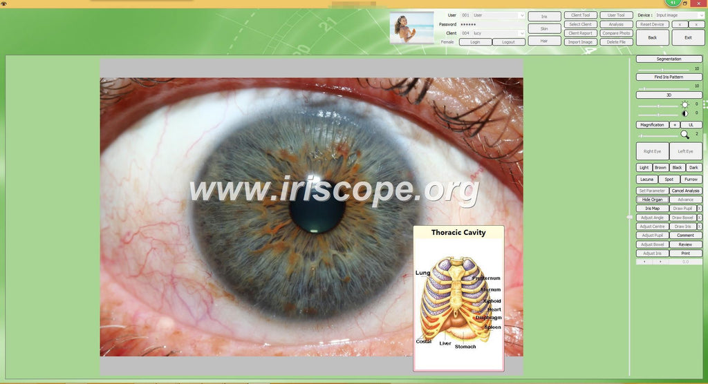 iridologycamera with english and spanish iridology software