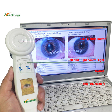 5MP Portable iriscope Usb iridology camera